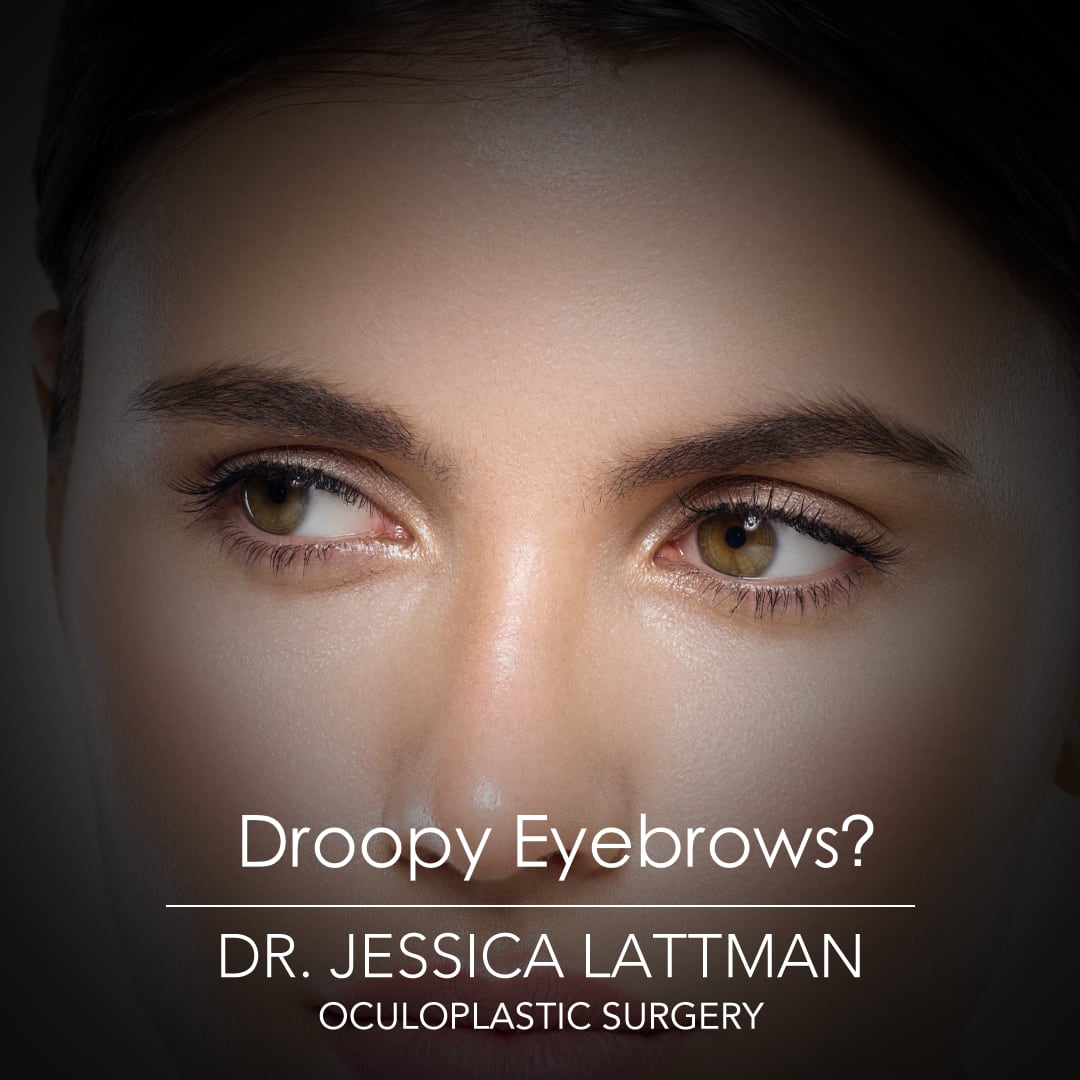 Droopy Eyebrows