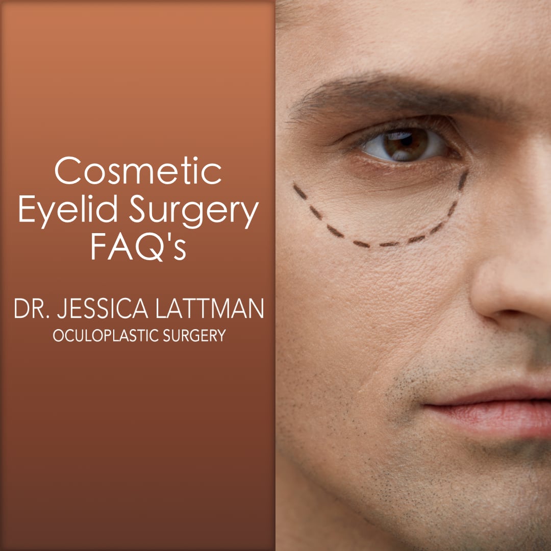 FAQ's cosmetic eyelid surgery