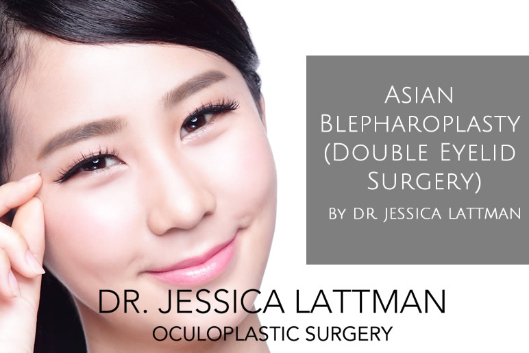 Asian Eyelid Surgery NYC