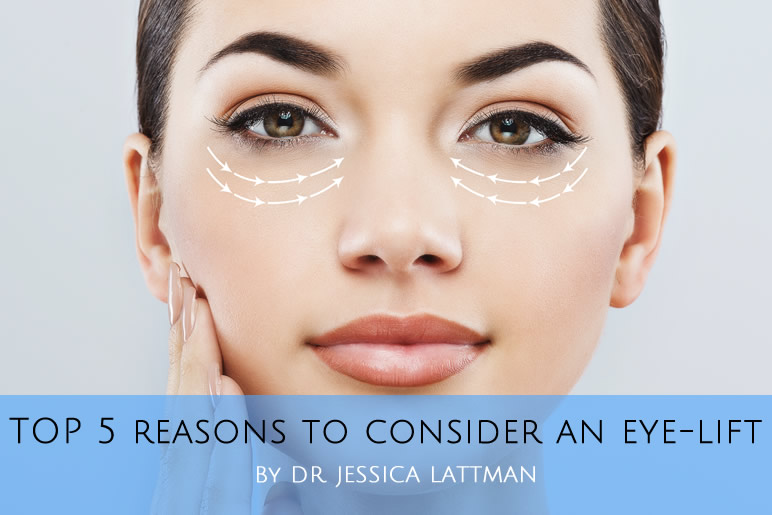 Top 5 Reasons to Consider an Eyelift