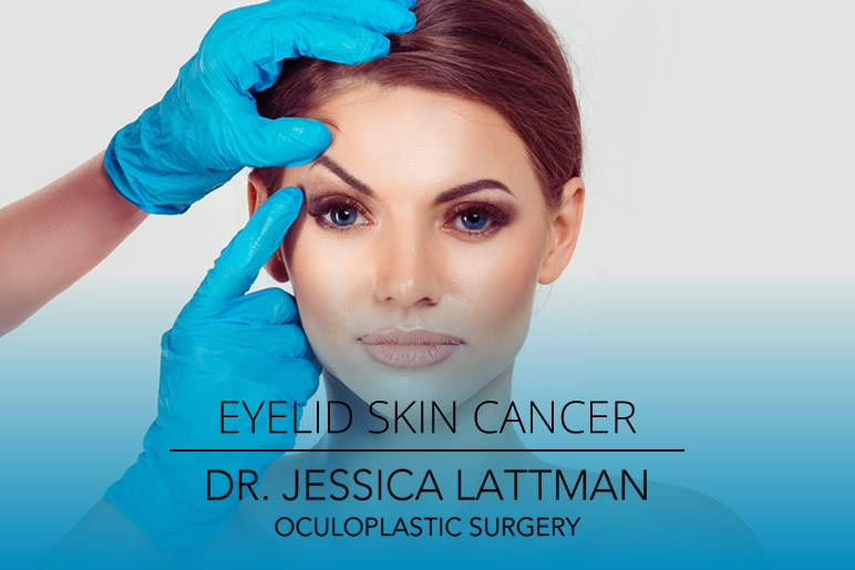 Eyelid Skin Cancer Repair NYC