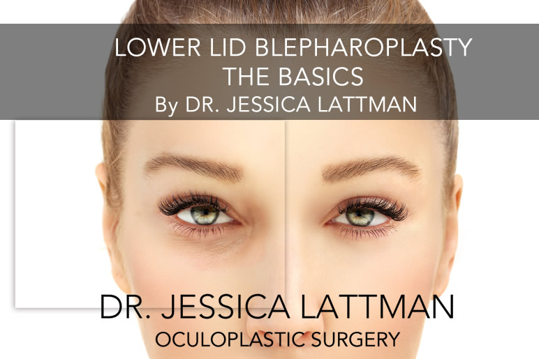 Lower Blepharoplasty The Basics By Dr Jessica Lattman
