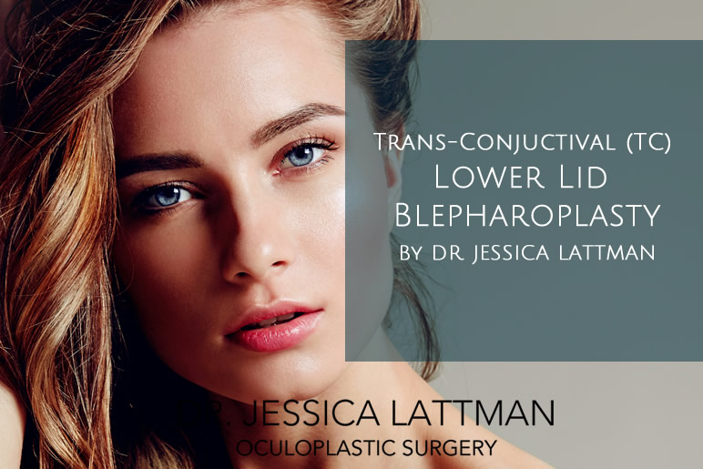 Trans Conjunctional TC Lower Lid Blepharoplasty