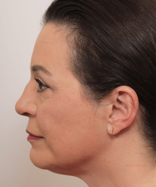 Lattman-Gallery Scroll10