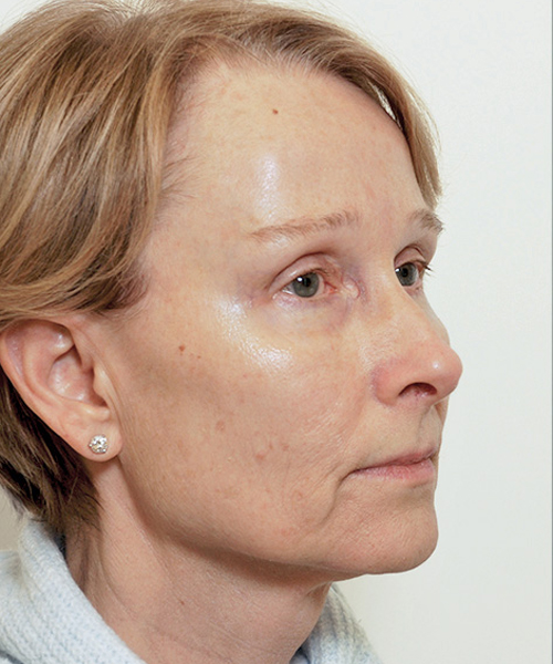 Lattman-Gallery Scroll2