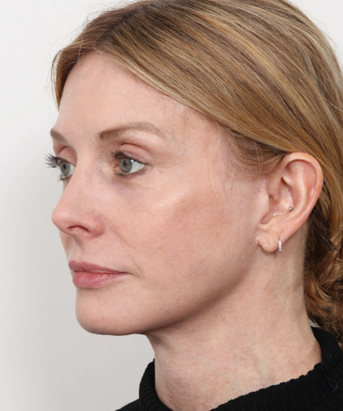 Lattman-Gallery Scroll6