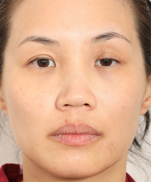 Lattman-Homepage-Results11