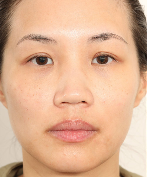 Lattman-Homepage-Results12