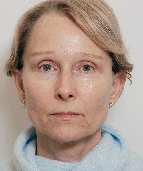 Lattman-Homepage-Results2