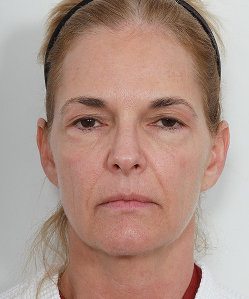 Lattman-Homepage-Results3