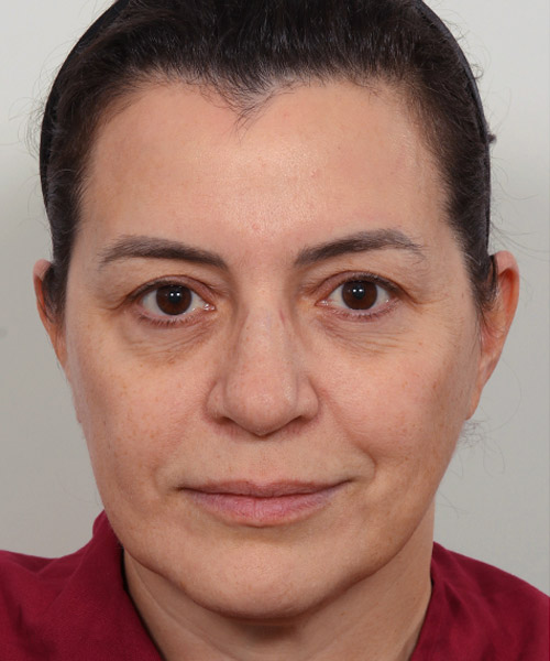 Lattman-Homepage-Results5