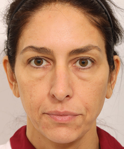 Lattman-Homepage-Results7