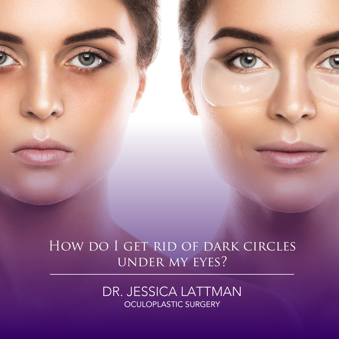 How do I get rid of dark circles under my eyes?